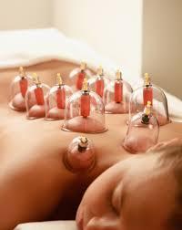 Massage aux ventouses  ou cupping therapy massage. 